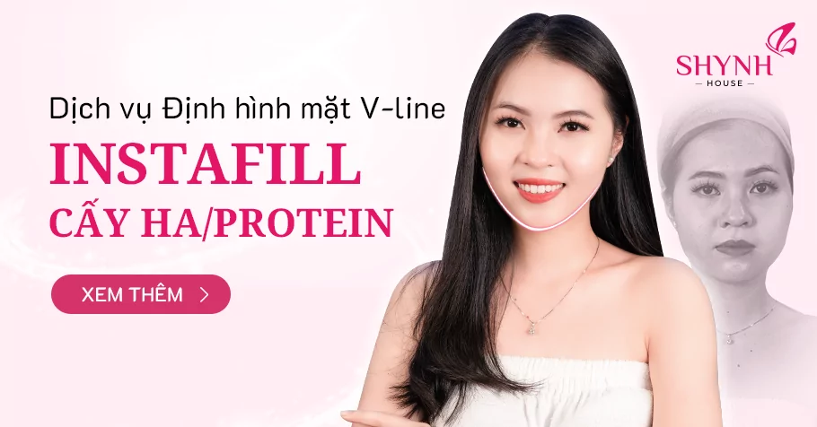 Instafill cấy Ha/Protein