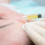 PRP - trích ly huyết tương giàu tiểu cầu phép màu cho làn da