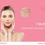 7 NGUYÊN TẮC VÀNG CHĂM SÓC CHO LÀN DA SAU MỤN. – Shynh House Spa & Cosmetics