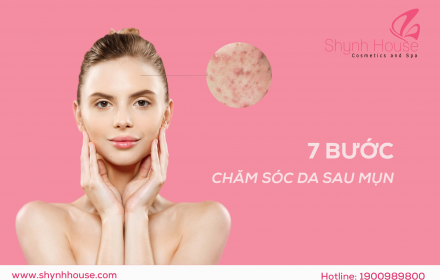 7 Nguyên tắc vàng chăm sóc cho làn da sau mụn 7 Nguyên tắc vàng chăm sóc cho làn da sau mụn