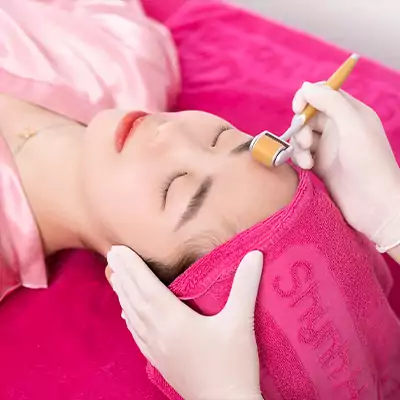 Bác sĩ tiến hành lăn kim, cắt đứt liên kết đáy sẹo.