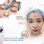 Exilis Ultra 360 – siêu công nghệ trẻ hóa da thách thức thời gian