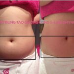 TIÊM TAN HOÁ LỎNG MỠ - LẤY LẠI VÓC DÁNG S-LINE, SỞ HỮU GƯƠNG MẶT V-LIN – Shynh House Spa & Cosmetics