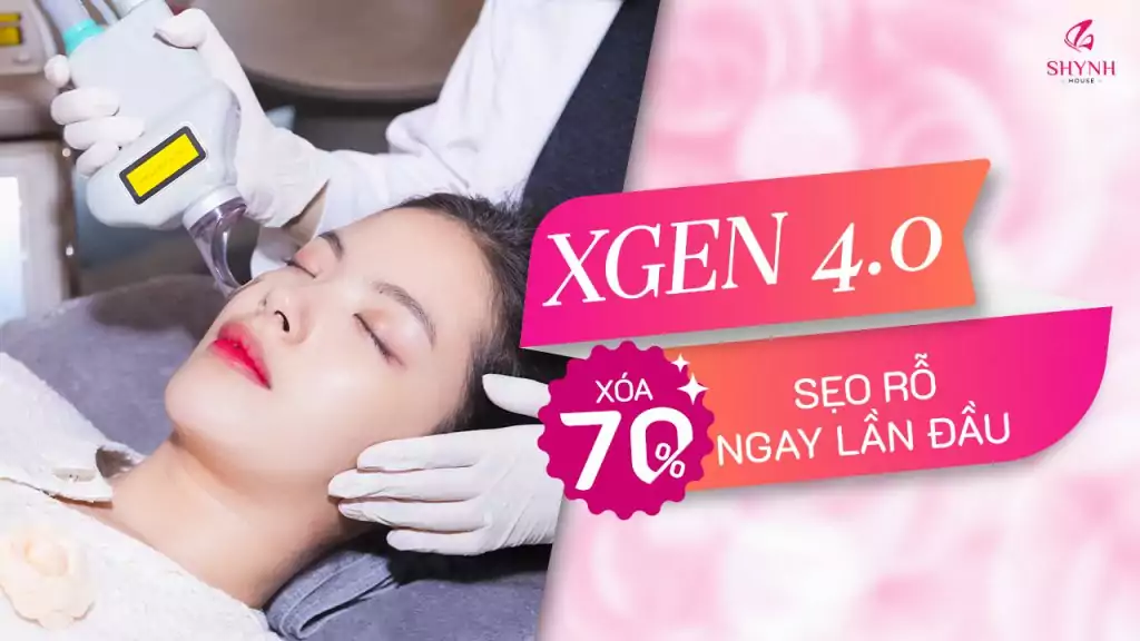 Trị sẹo rỗ X.Gen 4.0 sạch bóng sẹo rỗ