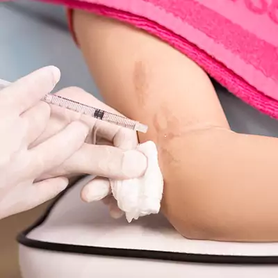 Bác sĩ tiến hành tiêm sẹo lồi.