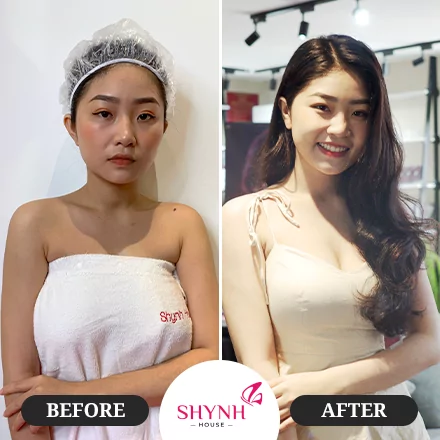 Khách hàng sau khi thực hiện Công nghệ tắm tẩy Organic