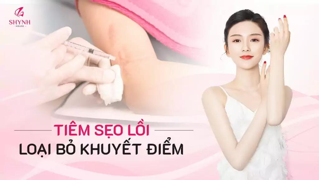 Phương pháp tiêm sẹo lồi