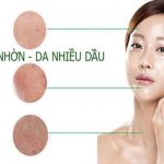 Da bóng nhờn dễ gây mụn