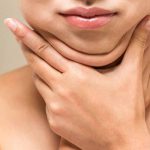 Béo mặt và cằm do nhiều nguyên nhân gây ra