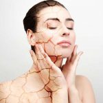 Da khô thường có biểu hiện bong tróc, sạm, nứt