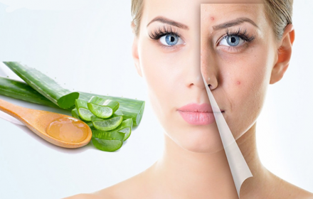 Top 10+ cách trị thâm mụn cấp tốc từ tự nhiên Top 10+ cách trị thâm mụn cấp tốc từ tự nhiên