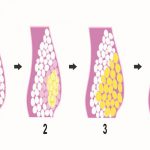 Cơ chế giảm mỡ