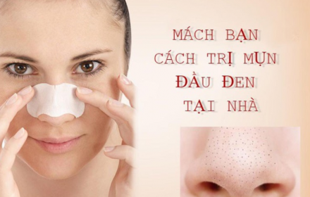 Cách trị mụn đầu đen tại nhà nhanh chóng, hiệu quả Cách trị mụn đầu đen tại nhà nhanh chóng, hiệu quả