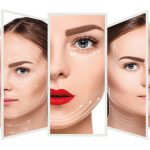 căng da mặt bằng chỉ