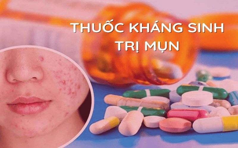 chữa mụn sưng viêm