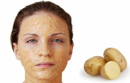 Bật mí 10 cách trị nám da An toàn và hiệu quả Bật mí 10 cách trị nám da An toàn và hiệu quả
