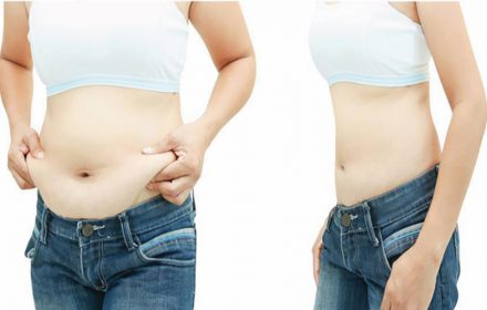 Cấy tinh chất giảm béo là gì? Cấy tinh chất giảm béo có tốt không? Cấy tinh chất giảm béo là gì? Cấy tinh chất giảm béo có tốt không?