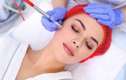 20 cách điều trị thâm mụn tại nhà nhanh mà hiệu quả bất ngờ 20 cách điều trị thâm mụn tại nhà nhanh mà hiệu quả bất ngờ