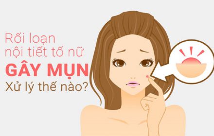 Góc lý giải thắc mắc làm sao biết mình bị mụn nội tiết Góc lý giải thắc mắc làm sao biết mình bị mụn nội tiết