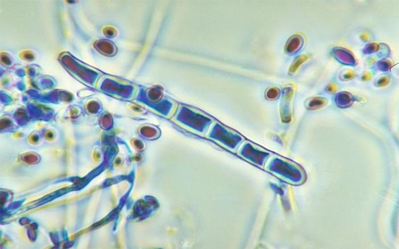 Trichophyton và Microsporum