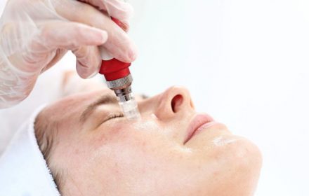 Phi kim và những điều không phải ai cũng biết Phi kim và những điều không phải ai cũng biết