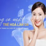 Nâng cơ trẻ hóa