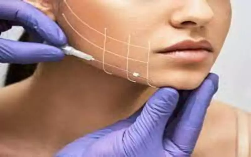 chỉ vàng để xóa nhăn