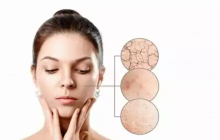 Cách kiểm tra da mặt thuộc loại da nào và phương pháp chăm sóc phù hợp Cách kiểm tra da mặt thuộc loại da nào và phương pháp chăm sóc phù hợp