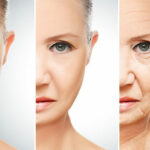 Căng da mặt nội soi