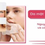 da mỏng và yếu đi