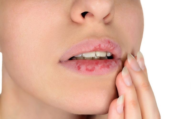 Dấu hiệu phun môi bị hỏng và những cách khắc phục hiệu quả