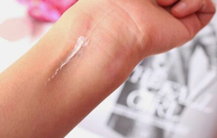 Hướng dẫn peel da tại nhà cực an toàn mà siêu hiệu quả cho các nàng Hướng dẫn peel da tại nhà cực an toàn mà siêu hiệu quả cho các nàng