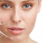 Kem tái tạo da sau khi bắn laser