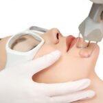 Công nghệ laser fractional CO2