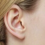 Mụn nhọt ở tại