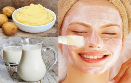 Mách bạn 12 cách trị mụn thịt an toàn và hiệu quả Mách bạn 12 cách trị mụn thịt an toàn và hiệu quả