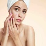 Chăm sóc da sau khi nặn mụn