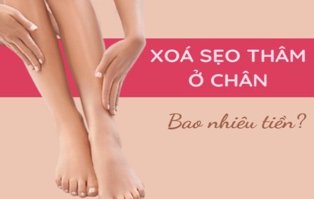Những điều cần biết về xóa sẹo thâm ở chân bằng laser Những điều cần biết về xóa sẹo thâm ở chân bằng laser