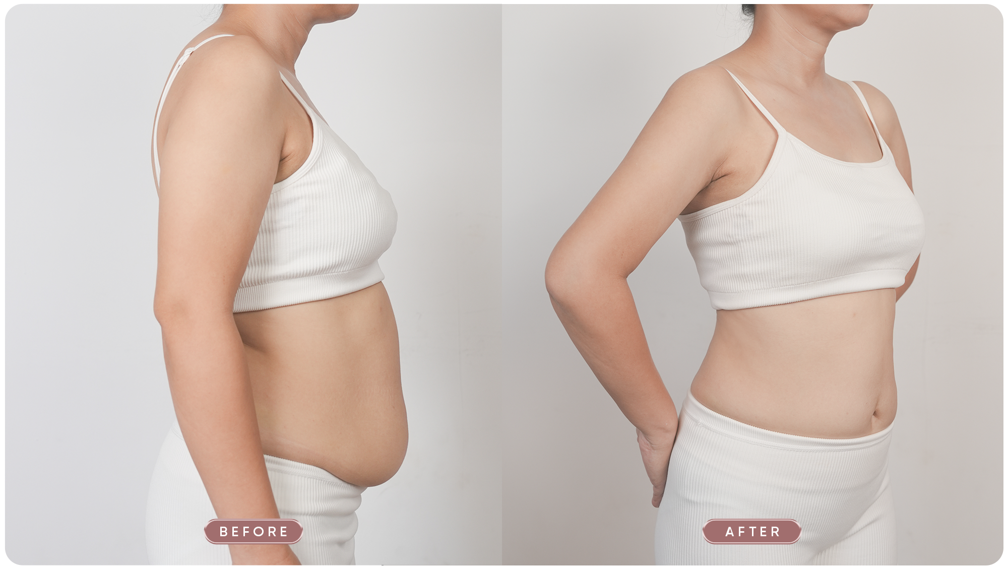 Slim Fit Promax | Before – After vóc dáng chuẩn S – Line