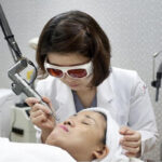 Bắn laser trị thâm giúp cải thiện thâm sau mụn, đốm nâu và mang lại làn da đều màu