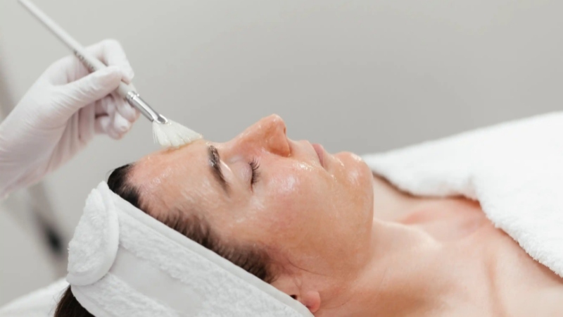 Bao lâu thì peel da 1 lần để đạt hiệu quả tốt nhất?