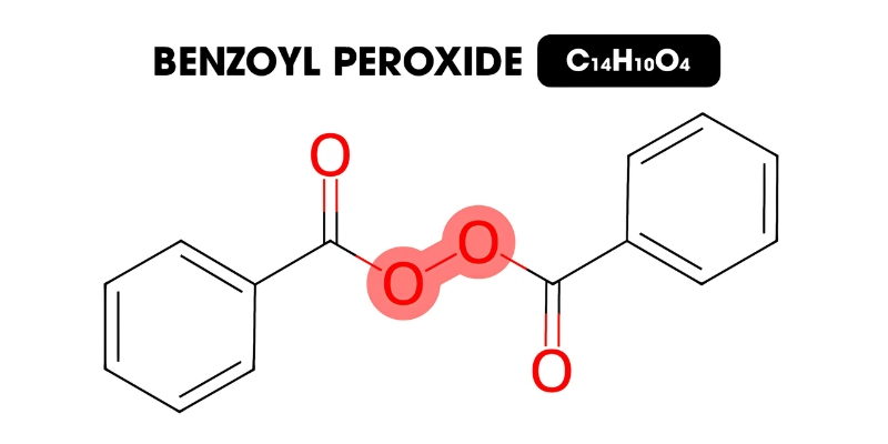 Dùng kem bôi chứa Benzoyl Peroxide để đẩy nhân mụn