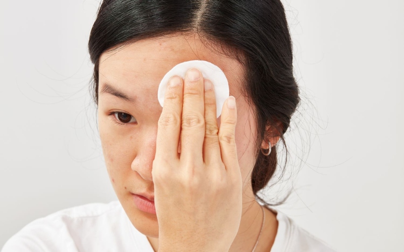 Thấm dung dịch sát khuẩn dịu nhẹ để làm sạch vết thương hở