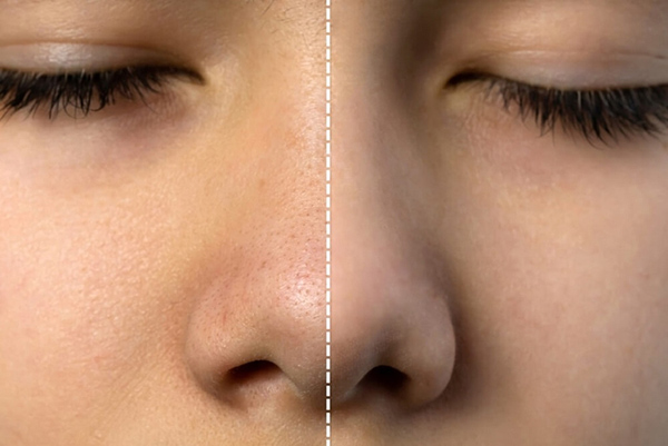 Vitamin C hỗ trợ tăng sinh collagen giúp da săn chắc và cải thiện độ mịn bề mặt da