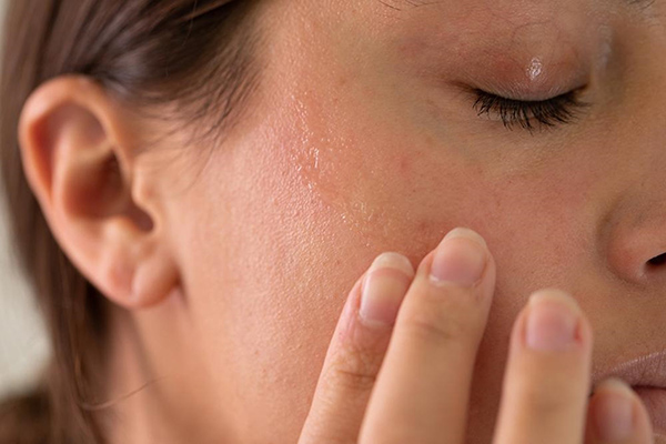 Bảo vệ da khỏi tia UV và môi trường ô nhiễm giúp duy trì cấu trúc lỗ chân lông ổn định