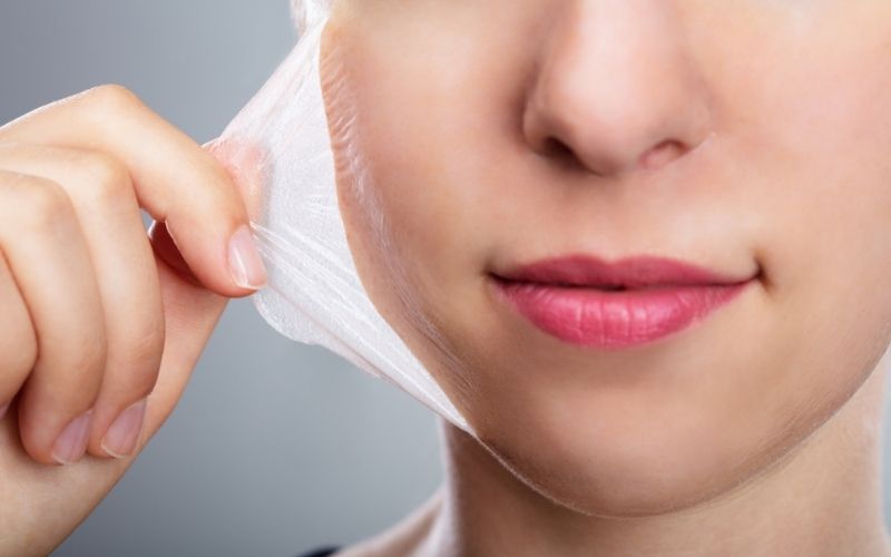 Làn da dễ bị tổn thương do tia UV sau khi peel
