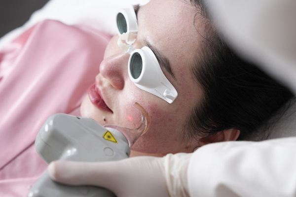 Laser trị thâm mụn giúp da đều màu hơn với độ chính xác cao