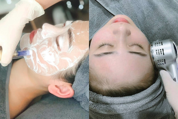 Cấy nano và điện di tinh chất giúp giảm sưng đỏ và thúc đẩy tái tạo da
