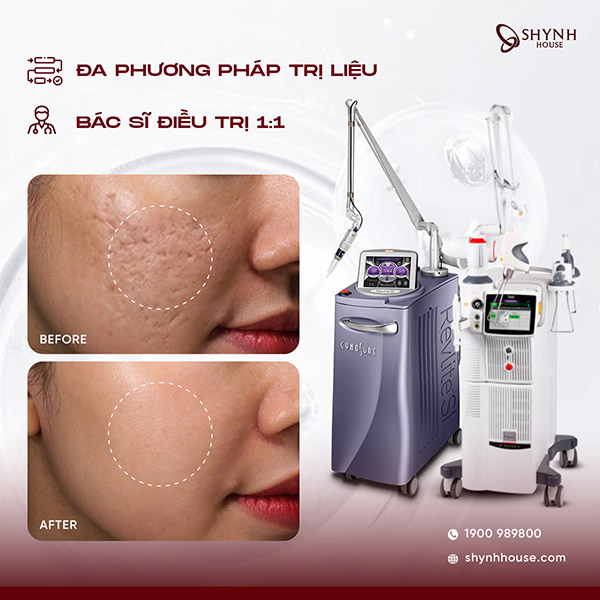 Cấu trúc da và cơ chế tái tạo collagen trong liệu trình trị sẹo rỗ chuyên sâu