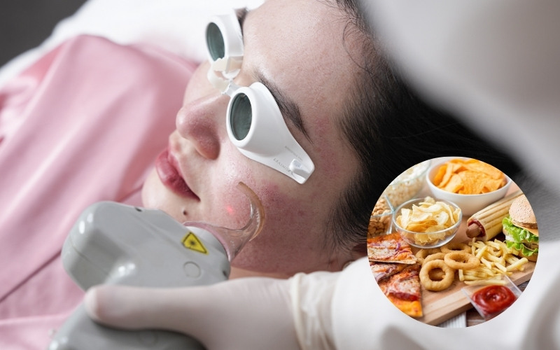 Mới nặn mụn kiêng ăn gì để tránh thâm?